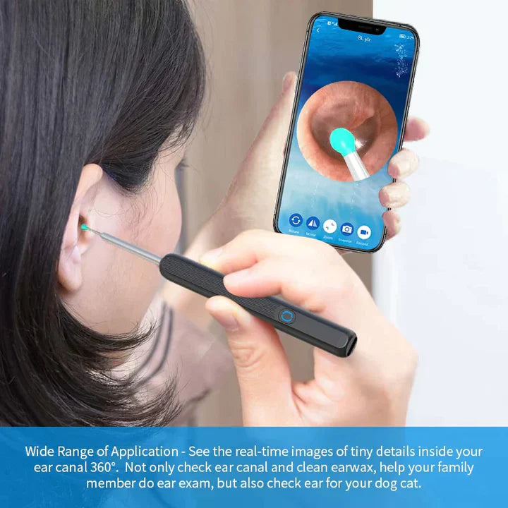 ENDOSCOPE EAR WAX CLEANER